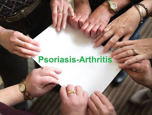 Übergewicht, Medikamente: Neue Studien Zur Psoriasis-Arthritis ...